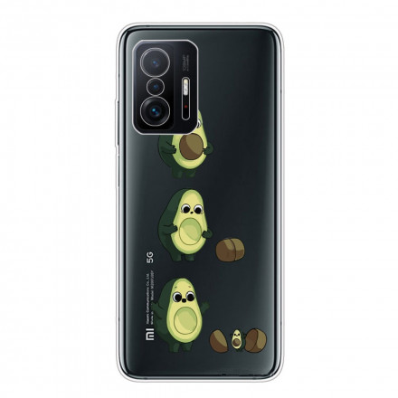 Coque Xiaomi 11T La vie d'un Avocat