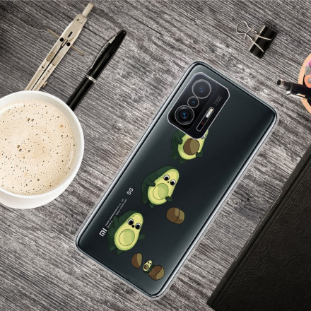 Coque Xiaomi 11T La vie d'un Avocat