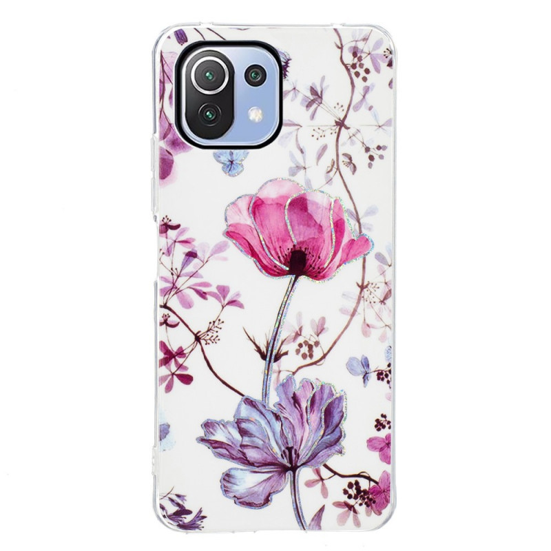 Coque Xiaomi 11 Lite 5G NE/Mi 11 Lite 4G/5G Marbrée Fleurs